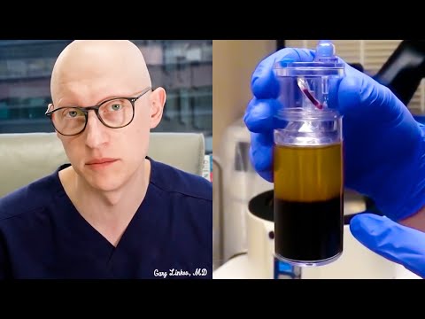 Which PRP System