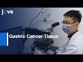 Elastic Staining on slides of Gastric Cancer Tissue | Protocol Preview