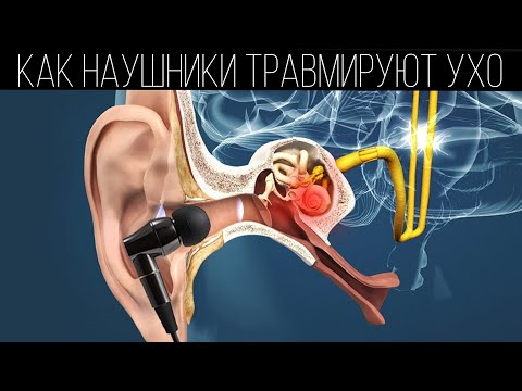 Как наушники ухудшают слух? | Вред наушников | ПОЛЕЗНЫЙ ЮТУБ