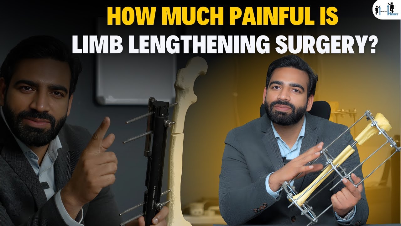 Насколько болезненна операция по удлинению конечностей? | Операция по увеличению роста в Индии | ...