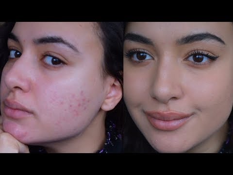 HOW TO LIGHTLY COVER ACNE MARKS WITH BAREMINERALS POWDER FOUNDATION| little coverage makeup acne