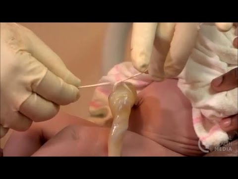 Video: How To Tie A Kit For A Newborn Baby