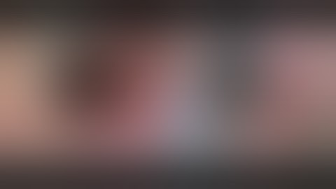 Excision Biopsy of the Ocular Surface Squamous Neoplasia (OSSN)