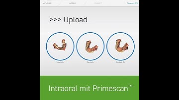 Dentsply Sirona® Primescan® Anwendung