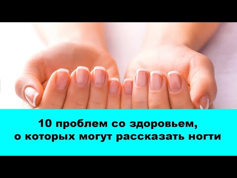 10 проблем со здоровьем, о которых могут рассказать ногти