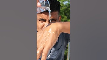 Sulphuric acid V/S human cloth ⚠️ #shorts #discoveryhacker