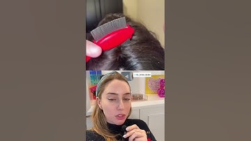 Thumbnail of Scalp Psoriasis: What NOT To Do #shorts