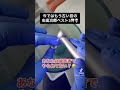 みんなこんな古臭い治療されてないよね？？#Shorts