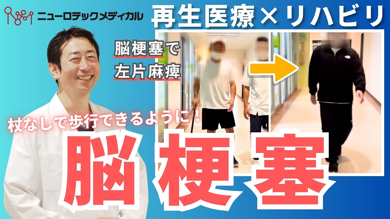 【症例動画】脳梗塞を発症するも懸命なリハビリの末、左上肢の機能改善や歩行速度の向上が！さらに杖なしでの歩行も可能に！幹細胞治療による治療前後の変化をご紹介【再生医療×リハビリ】