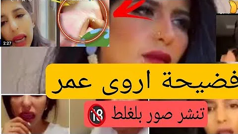 فيديو اروى عمر بالغلط