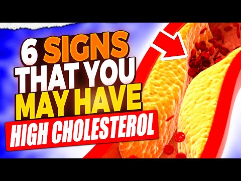 High Cholesterol Alert: 6 Symptoms You Shouldn't Ignore