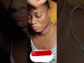ASMR| Face Clensing| #pimplepopping #asmr #viral