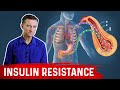 28 Insulin Resistance Symptoms