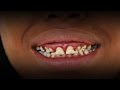 Woman Who Never Lost Her Baby Teeth