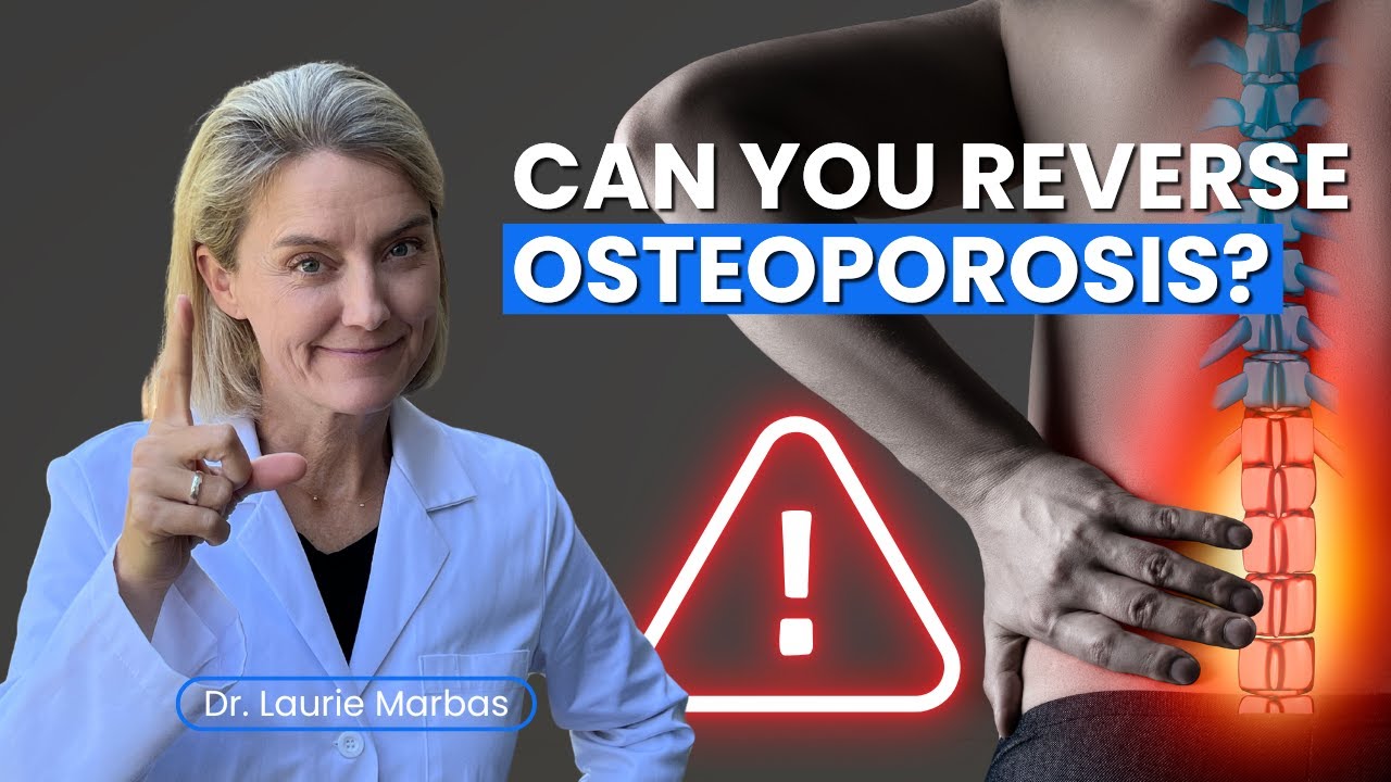 Reversing Osteoporosis: Can Lifestyle Changes Make a Difference? - YouTube