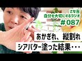 【ラジオ】シアバターに手を出す／ケーキ試作品・第二弾／手のアトピー・あかぎれ警報！／アサーティブ【さな吉・自分を大切にするラジオ】#087