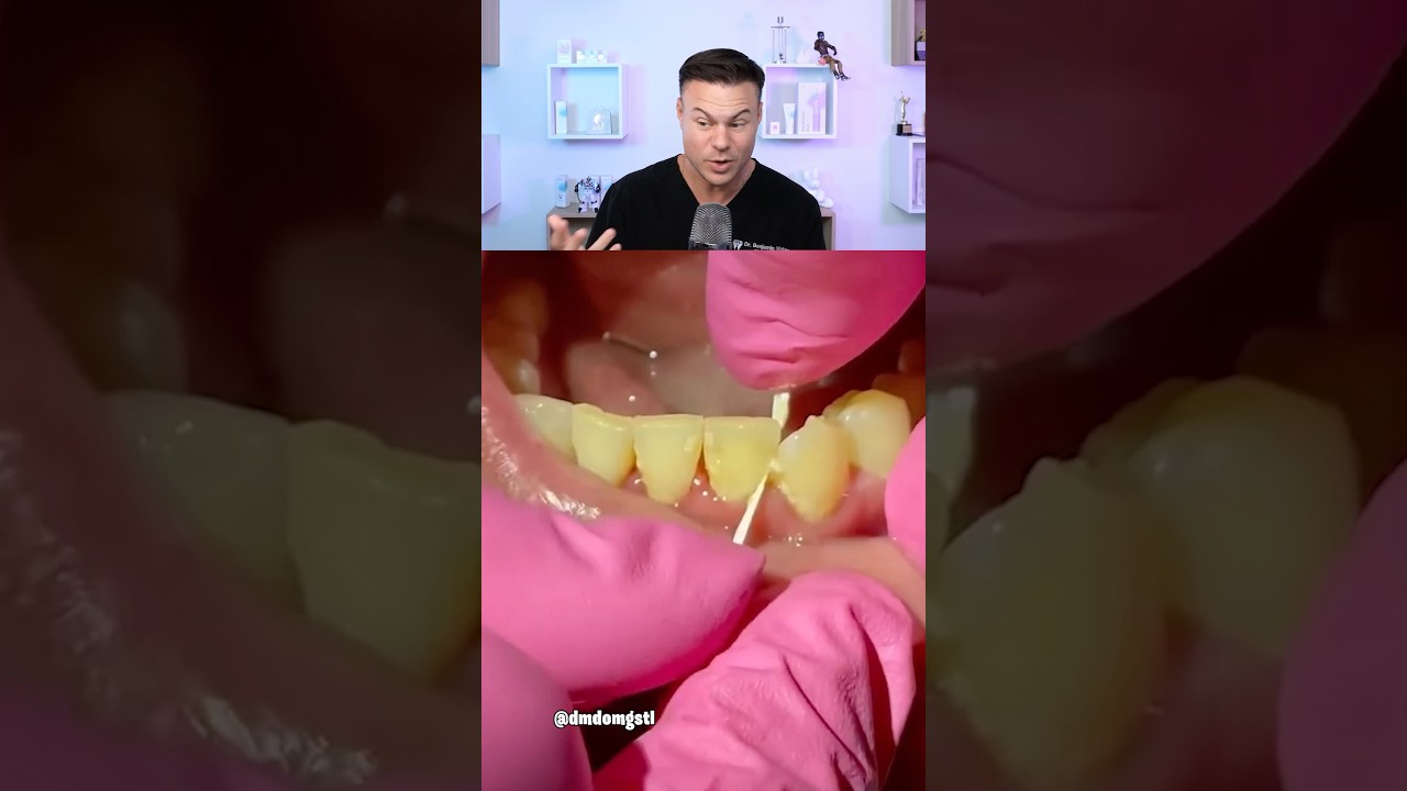 How You Should REALLY Floss Your Teeth!  😮🦷