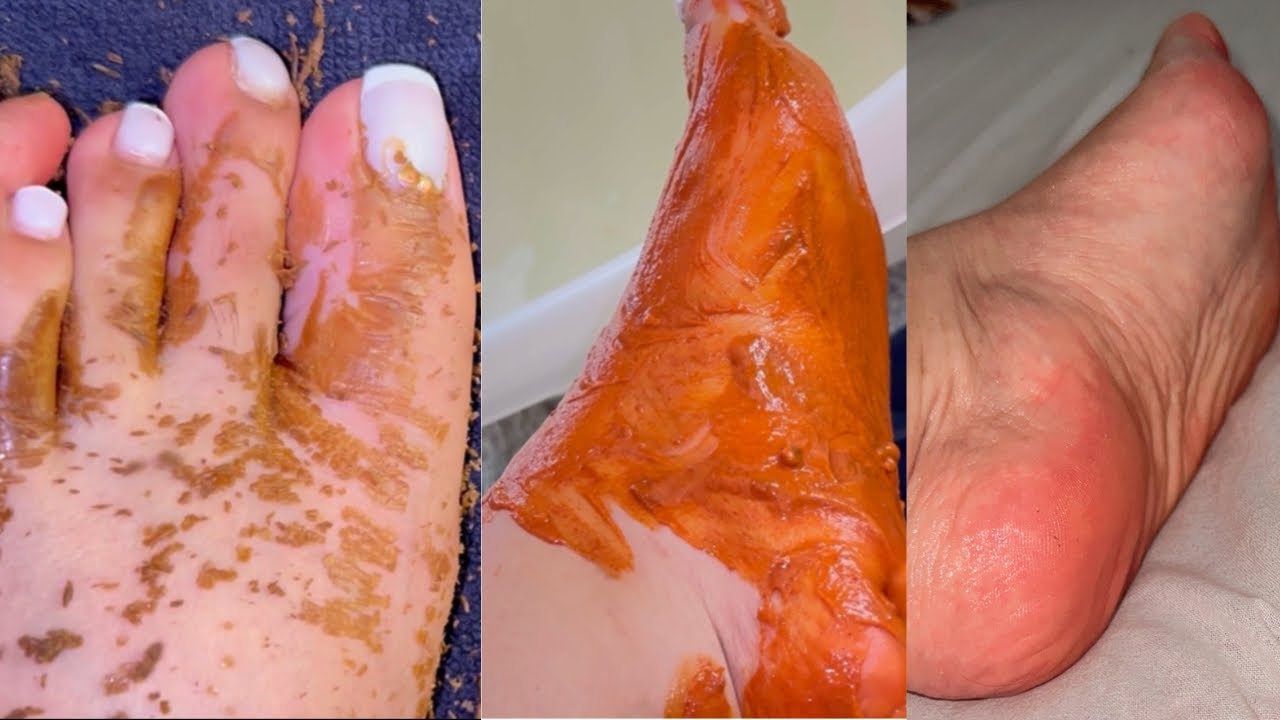 لبسي صندالتك وراسك مرفوع للسما لي شافك يسولك على سر كديماتك👌روتين قاتل سحري يخلي رجيلات يشعلو رطبين