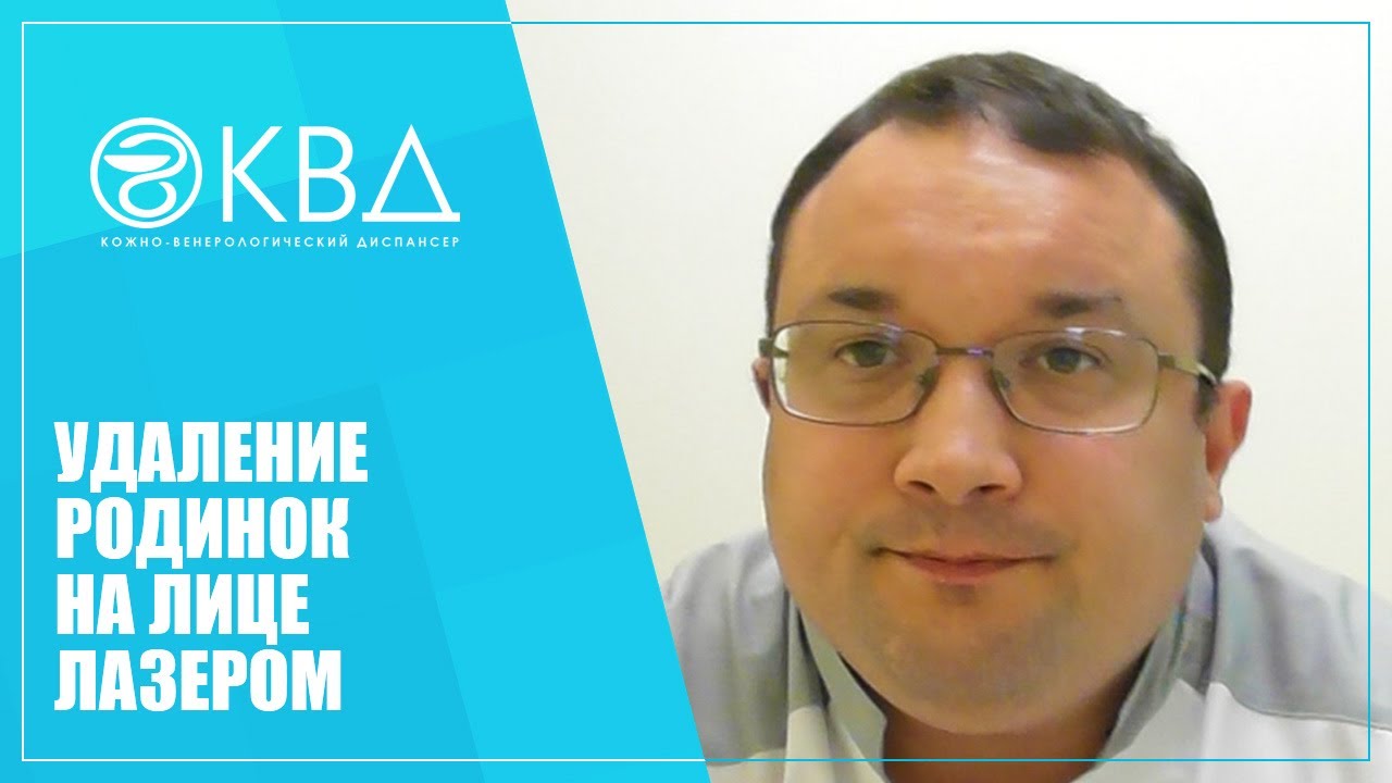 1276 Удаление родинок на лице лазером