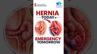 Modern Hernia Treatment with Advanced Laparoscopic Surgery | Sreshta Multi Speciality Hospitals