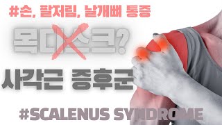 (손,팔저림,날개뼈통증)혹시 목디스크!? 놉놉! &#39;사각근증후군&#39; (Scalenus Syndrome Simple 4 Stretches You Should Do Everyday!)