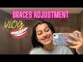 Braces Adjustment VLOG | What can you expect from braces adjustment appointments??