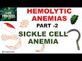 Hemolytic Anemias- Part 2: SICKLE CELL ANEMIA- Pathology