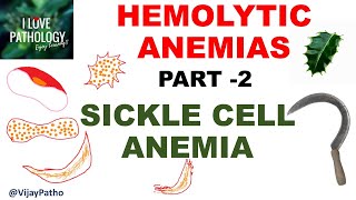 Hemolytic Anemias Part 2: SICKLE CELL ANEMIA Pathology