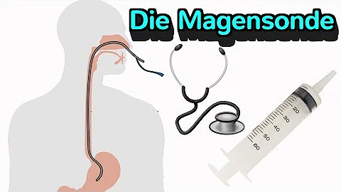 Wie lange kann man mit einer Magensonde ernährt werden?