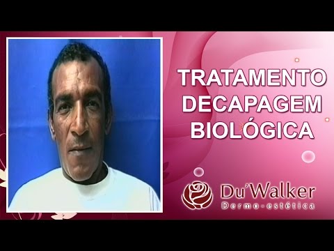 Vídeo: O que é decapagem a vácuo?