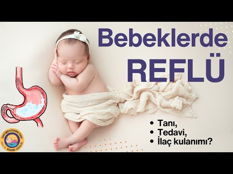 Bebeklerde Reflü: Kusma Sorunu, Tanı ve Tedavi Yöntemleri