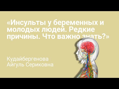 Перед инсультом ваше