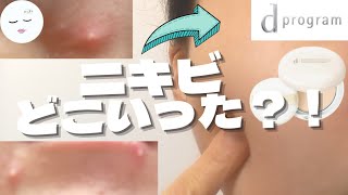 【dプログラム】リピ買い！使って良かった！！ニキビ予防パウダー