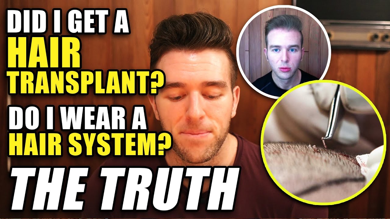 have-i-had-a-hair-transplant-or-do-i-wear-a-hair-system-the-truth