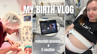 MY BIRTH VLOG & STORY | Induction & Csection