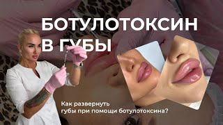 видео: Ботулотоксин в губы | Как при помощи ботулотоксина развернуть губу? | Техника картинка: Ботулотоксин в губы | Как при помощи ботулотоксина развернуть губу? | Техника