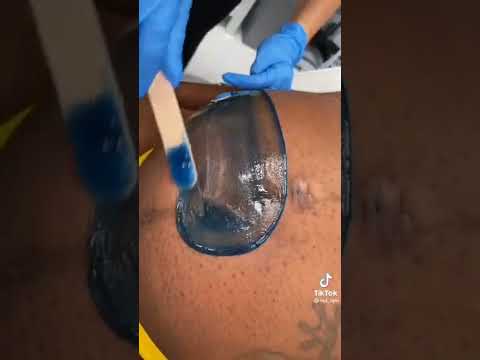 Pregnant mother getting rid of belly hair with wax🤰🍐