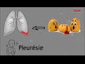 Pleursie  tous ce que vous devez connatre  cours  pneumophtisiologie