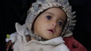 ريبورتاج الجمعية اليمنية لمرضى الثلاسيميا والدم الوراثي