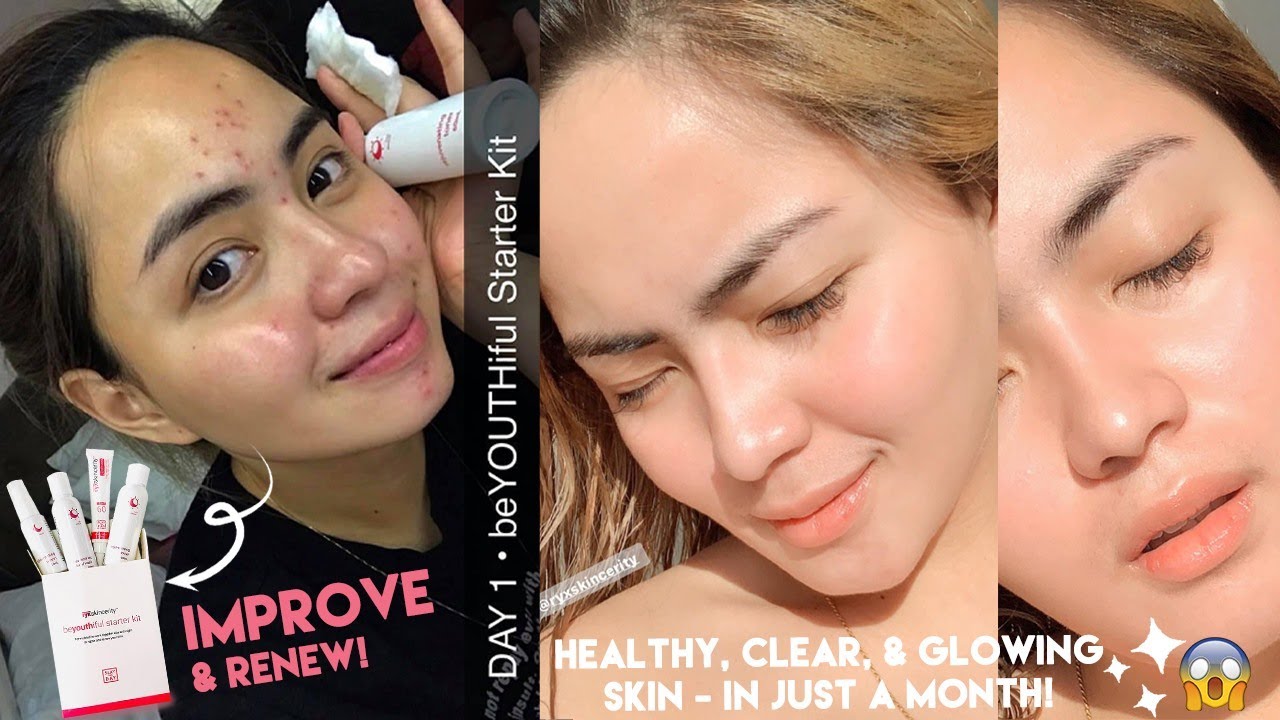 HOW I GOT RID OF MY PIMPLES || RYX SKINCERITY BEYOUTHIFUL STARTER KIT ...