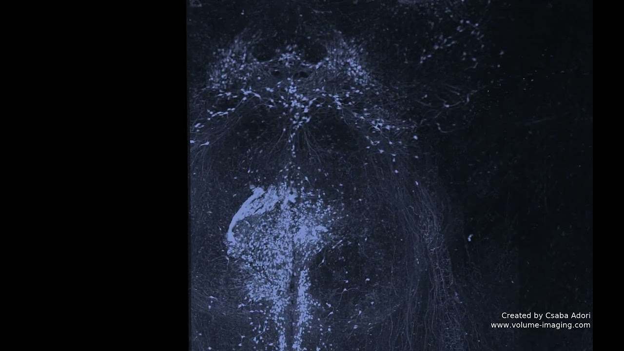 3D volume imaging - CATECHOLAMINERGIC NUCLEI MOVIE 1