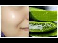 How to get clear, glowing, spotless skin by using aloe Vera gel