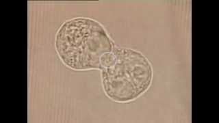 ZEISS Laser Capture Microdissection (LCM): Optical Trapping & Cell Fusion with PALM CombiSystem