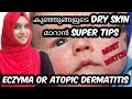 How to Cure Dry Skin in Babies | Eczyma or Atopic Dermatitis Malayalam