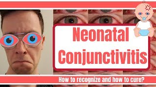 Neonatal conjunctivitis (Pinkeye): Cause and cure?