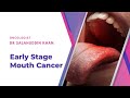 Oral cancer  pathogenesis diagnosis and treatment strategies  dr salahuddin khan