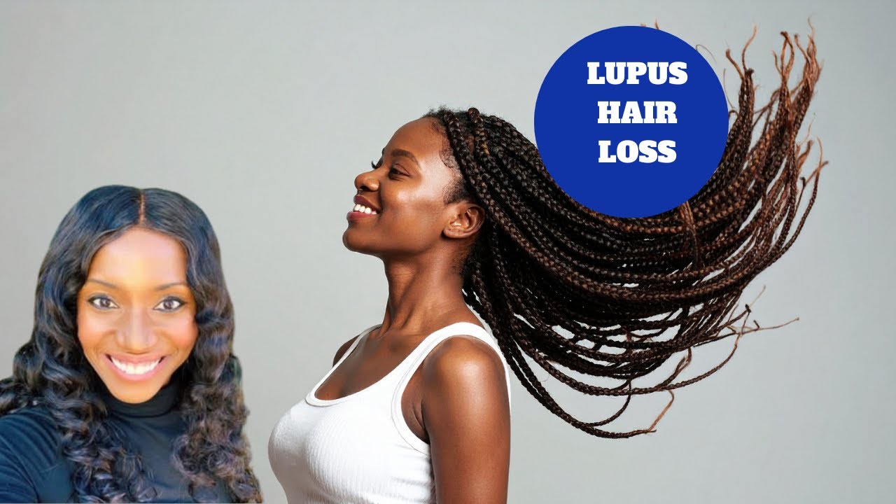 CONFRONTING LUPUS HAIR LOSS THE TRUTH YouTube