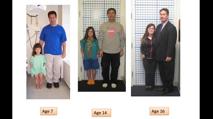 Dr. S. Robert Rozbruch - STATURE LENGTHENING (Anch...