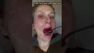 ترفند خانگی درمان سرفه و گلودرد; Coughing Home Remedy