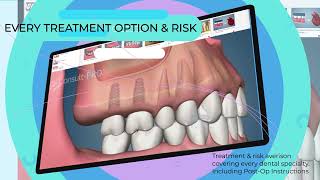 Consult-PRO: Software For Dentists | Post Op and Pre Op Videos | Informed Consent | 2023